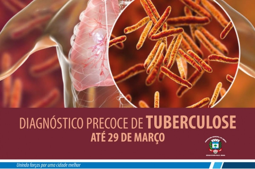 Prefeitura faz busca ativa de pacientes com tuberculose