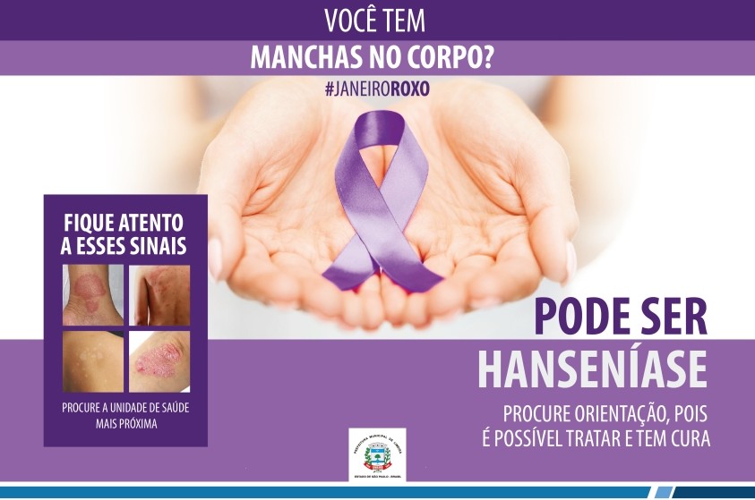 Prefeitura de Limeira lança campanha de conscientização sobre hanseníase