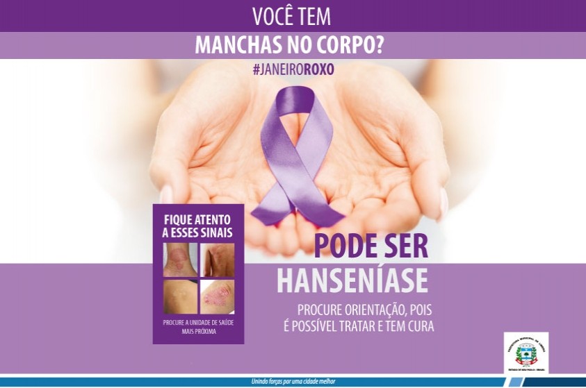 Hanseníase: campanha conscientiza sobre sintomas e tratamento